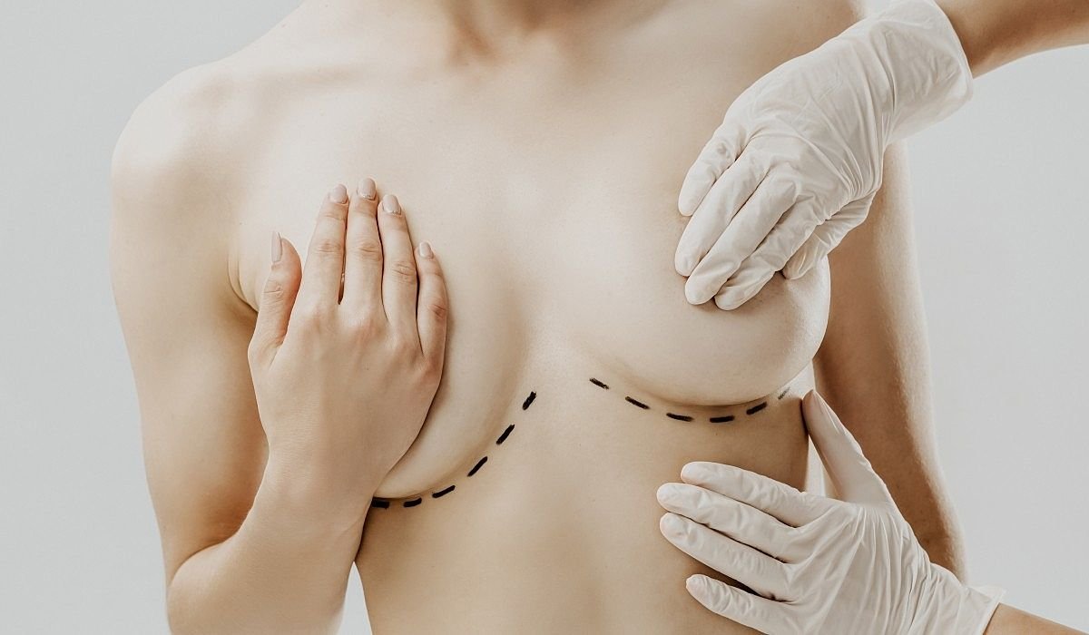 Breast Surgery