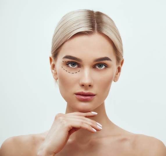 Blepharoplasty